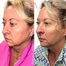 𝐁𝐚𝐫𝐞 𝐀𝐞𝐬𝐭𝐡𝐞𝐭𝐢𝐜𝐬 𝐃𝐚𝐥𝐥𝐚𝐬