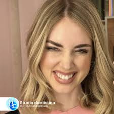 Anche la bellissima Chiara Ferragni soffre di Recessioni Gengivali! E'  infatti un problema piuttosto diffuso che può colpire persone di tutte le  età. Si verifica quando il dente appare più lungo del