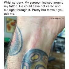 So, it is acceptable to get a tattoo 3 years after surgery. Upworthy The Surgeon We All Would Want Follow Upworthy On Ig For The Best Of Humanity Https Buff Ly 3qkqthm Facebook