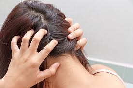 5 طرق طبيعية للعناية بالشعر الجاف بدون حرارة أو مواد كيميائية اليوم السابع