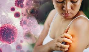 Cancer Symptoms Darker Yellow Or Reddened Skin Itching And Excessive Hair Growth Signs London Mail