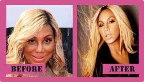 Not like many other public figures, . Tamar Braxton Plastic Surgery For Looks Improvement