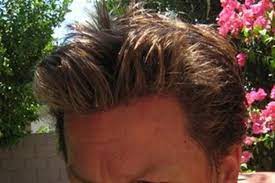 Pixie cut with long bangs. Hair Loss Forum