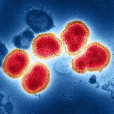 Image result for Influenza