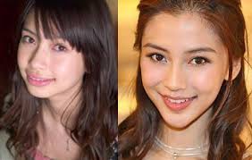 We did not find results for: Plastic Surgery The Maturation Of Angelababy Plastic Surgery Celebrity Plastic Surgery Chin Implant