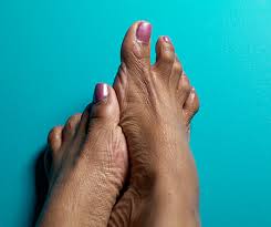 What does a good foot look like? Diabetes And Your Feet Cdc