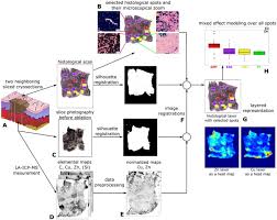 Check spelling or type a new query. Spatial Mapping Of Metals In Tissue Sections Using Combination Of Mass Spectrometry And Histology Through Image Registration Scientific Reports
