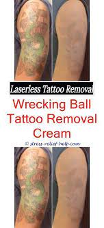 Tattoo removal cost is determined by size and desired outcome. Custom Temporary Tattoos How Much Is A Laser Tattoo Removal Cost Can You Get A Tattoo Over A Removed Tattoo Removal Cost Tattoo Removal Results Laser Tattoo
