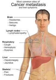 Pin On Health Tips