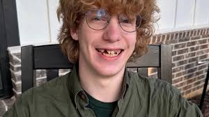 Fundraiser by John Gaertner : Help Seth Overcome His Dental Challenges