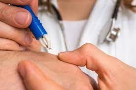 With Lyme Disease On The Rise Why Do So Many Chronic Sufferers Struggle To Convince Doctors They Re Sick