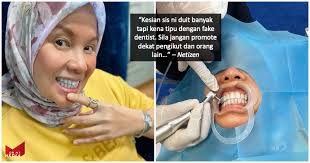 Rm1 to rm10 aplians tetap: Harga Veneer Gigi Di Klinik Kerajaan