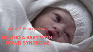 Having A Baby With Down Syndrome Youtube