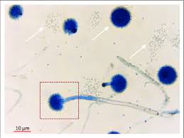 Fumigatus, will readily colonise buildings, favouring warm and damp or humid areas such as bathrooms and around window frames. Microscopic View Of Aspergillus Niger Stained With Lactophenol Cotton Download Scientific Diagram