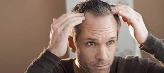 Suave® makes it easy to look & feel great everyday!. How To Tackle Men S Thinning Hair Balkania Info