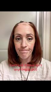 Well that was messier than expected 🤣#fyp #homehaircut #trichotillomania  #freshstart