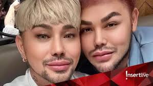 Potret Ivan Gunawan & Caren Delano Usai Oplas Disebut 'Twins' bak Kakak-Adik