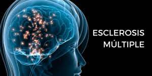 Jun 29, 2021 · las primeras señales de esclerosis múltiple a menudo no se diagnostican 29 jun 2021 / 05:30 pm /. Esclerosis Multiple Sintomas Iniciales Cuorecare