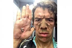 En el pelotón del actual tour de francia, un ciclista español hereda un asomo del aura genial, 'dandy' y escaladora de ocaña: Rigonator Uran El Ciclista Colombiano Sin Equipo Que Le Destruye Las Piernas A Froome Las2orillas