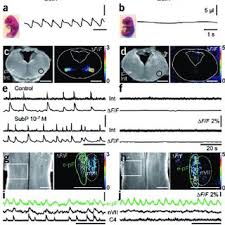 Check spelling or type a new query. Pdf Dissection Genetique Du Generateur Central Respiratoire Chez La Souris Neurones Rythmogenes Et Synchronisation Bilaterale