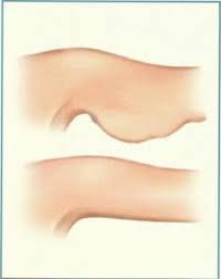 Spor Panosundaki Pin