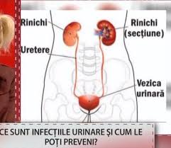 Cauzele infectiei urinare se pot imparti in doua categorii. PrÄƒfuit Motiva Prin Usturime Urinare Barbati Tratament Mariacastrojato Com