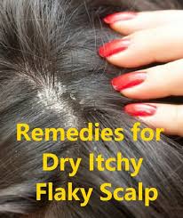 Dry Itchy And Flaky Scalp All Are Symptoms Of An Unhealthy Scalp And It Can Lead To Excessive Hair F Dry Flaky Scalp Dry Itchy Flaky Scalp Itchy Flaky Scalp