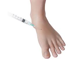 Image result for Injectable Corticosteroid