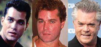 If we are still in doubt, let's take look carefully the changes in his appearance . Ray Liotta Plastic Surgery Before And After Pictures 2021