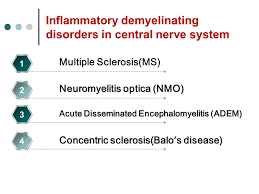 Meaning of demyelinating disease medical term. Demyelinating Disorders In Central Nerve System Ppt Video Online Download