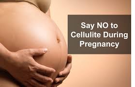 Best product at best price! Remove Cellulite Even When You Are Pregnant Can Be Done Ms Beauty Guru