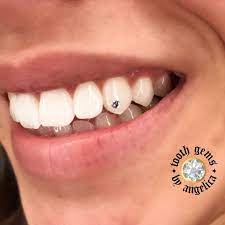 Simple Swarovski Tooth Gem Tooth Gem Teeth Jewelry Diamond Teeth