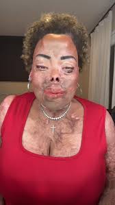 Dating with a visible difference.🦋, Research shows: ,