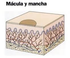 Las enfermedades de la piel pueden deberse a muchas causas, en ocasiones existe una predisposición genética, por ejemplo en la psoriasis. Lesiones Elementales De La Yt Estetica Y Salud Facebook