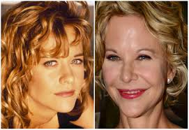 Anche i tagli di capelli tipici di quel periodo possano . Meg Ryan Irriconoscibile Prima E Dopo La Chirurgia Foto Shock