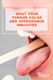Has Your Tongue Ever Turned White Or Yellow The Tongue Color Code Says A Lot About Your Health Learn More Abou Healthy Tongue Tongue Health Digestive Disease