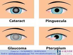 Pin On Aakash Eye Hospital