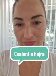 Hajhullás okai és természetes gyógymódok