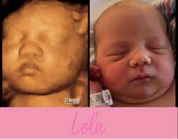 Cookin' for 35 weeks and almost done baking this sweet little cupcake! 🧁💓