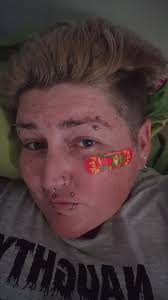 Does sun affect tongue piercing sensitivity?