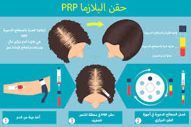 نصائح بعد حقن البلازما للوجه والشعر والشفايف تجميلي