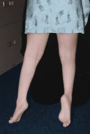 My 5 year old daughter keeps complaining of leg pain!. Toe Walking