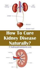 Kidney Disease Cases Chronic Kidney Disease Diet Kidney Disease Diet Kidney Disease