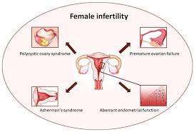 Image result for Female Infertility