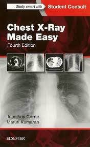 Chest X Ray Made Easy 4th Ed Made Easy Books X Ray Medical Textbooks