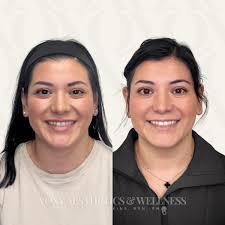 VOXY Aesthetics & Wellness