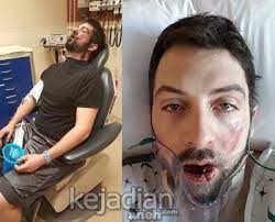 Buatmu yang belum tahu, silakan baca, ya! Awas Bahaya Vape Meledak Di Mulut Hoax Kah Ini