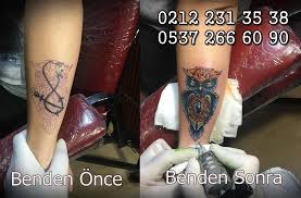 Baykus Dovmesi Kapatma Dovme Calismasi Istanbul Sisli Dovmeciler Murat Ari Dovme Tattoo Dovme Modelleri