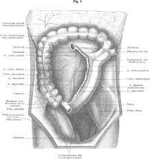 Laparoscopic right hemicolectomy for colon cancer. Figure 1 From Versuch Der Erklarung Eines Falles Von Seltener Lageabweichung Des Colon Descendens Und Des Colon Sigmoideum Beim Erwachsenen Menschen Aus Der Entwickelungsgeschichte Des Darmes Semantic Scholar
