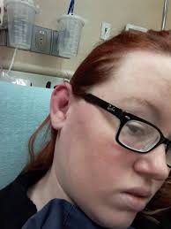 Diagnosed with multiple autoimmune diseases